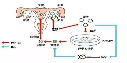 青岛试管婴儿存在一定的风险，包括：